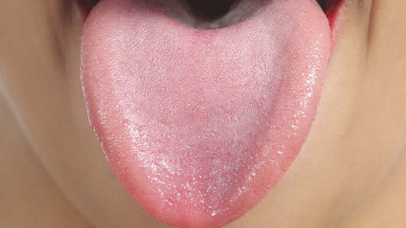 What Your Tongue is Telling You… And Me
