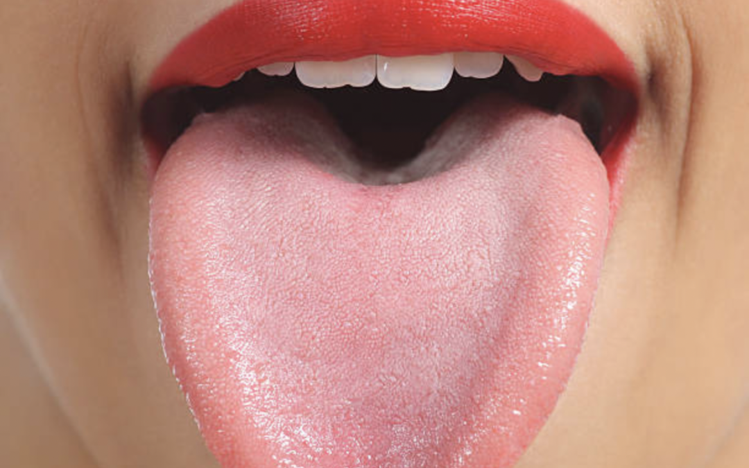 Chinese medicine tongue diagnosis, person sticking out tongue